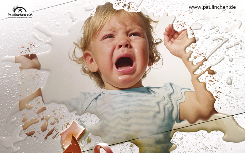 Kind hat sich verbrüht